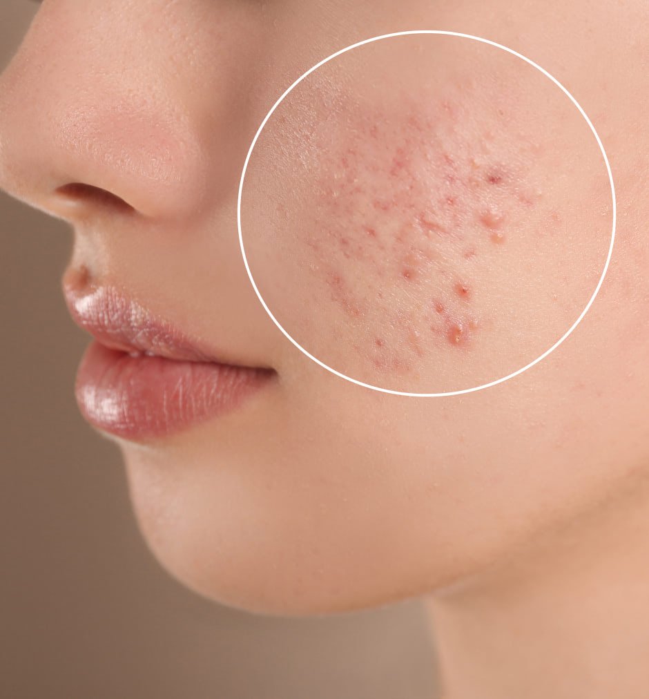 polynucleotide treatment