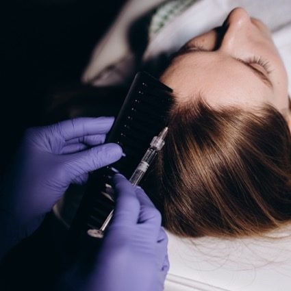 PRP Hair Treatment In London Offered By Best Aesthetic Clinic London - Dr SNA Clinic