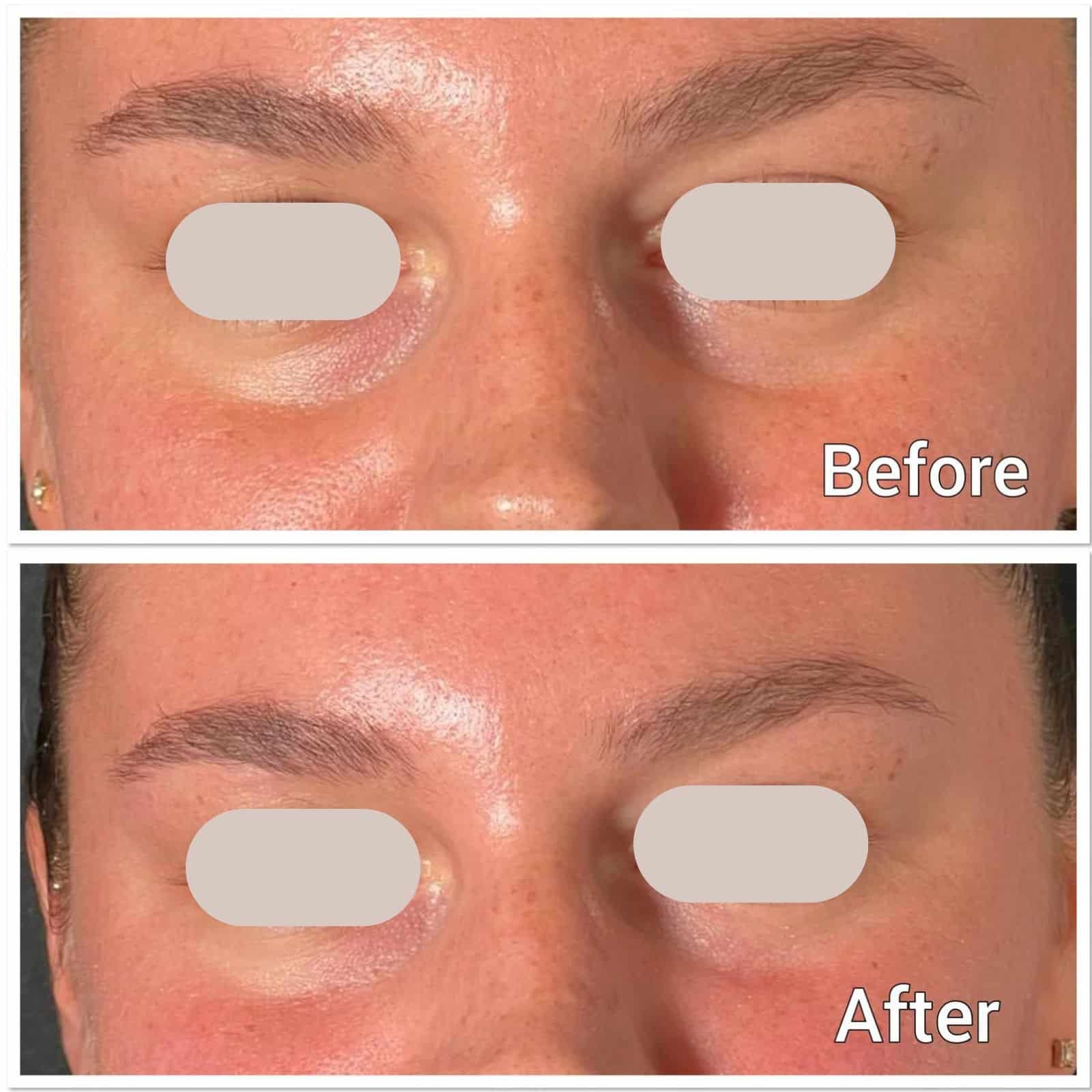 tear tough before and after effect