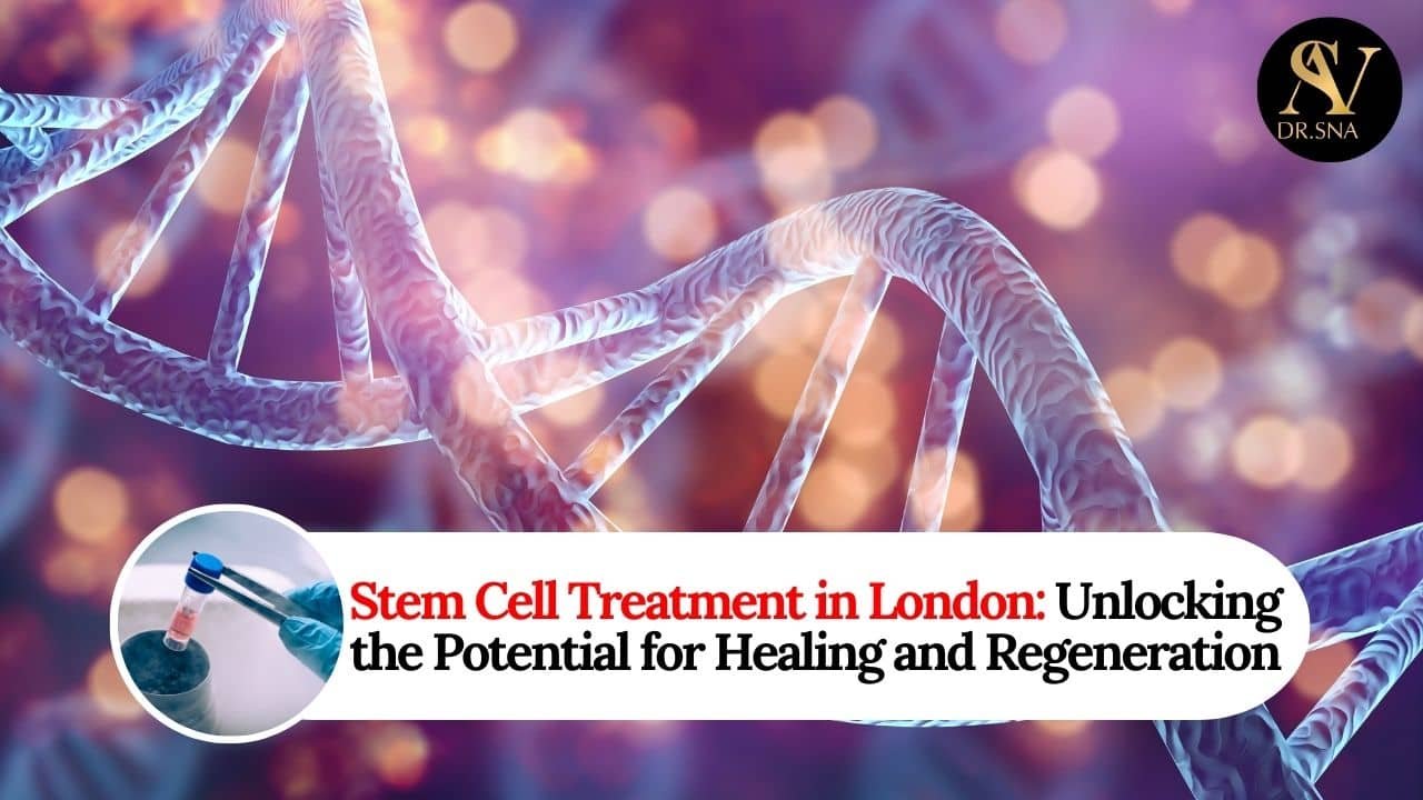 Stem Cell Treatment in London Unlocking the Potential for Healing and Regeneration
