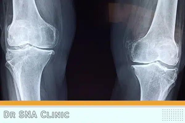 Stemcell Treatment London - evidence