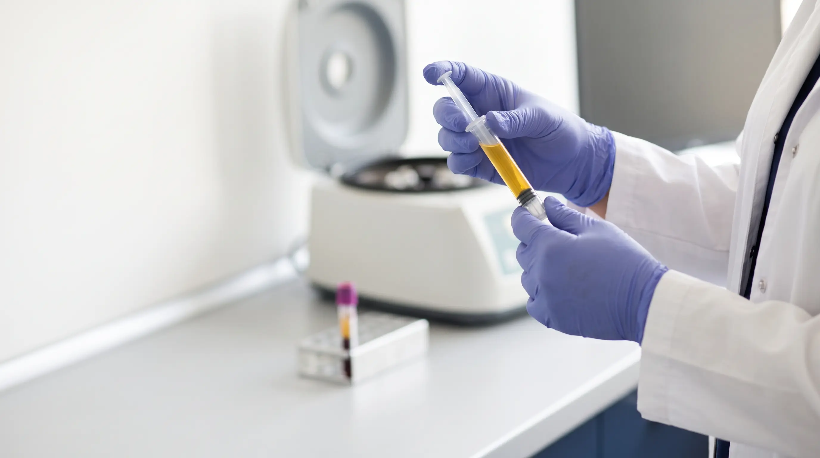 Doctor holding a syringe of platelet-rich plasma prepared for Priapus Shot therapy
